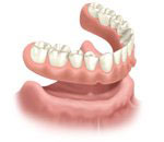 Diagram of lower dentures